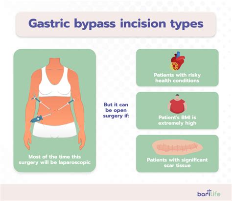 Risks of Gastric Bypass Surgery: Anastomotic Leaking